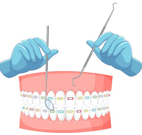 Orthodontic Treatment