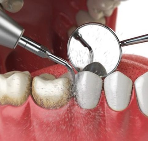 General Dentistry