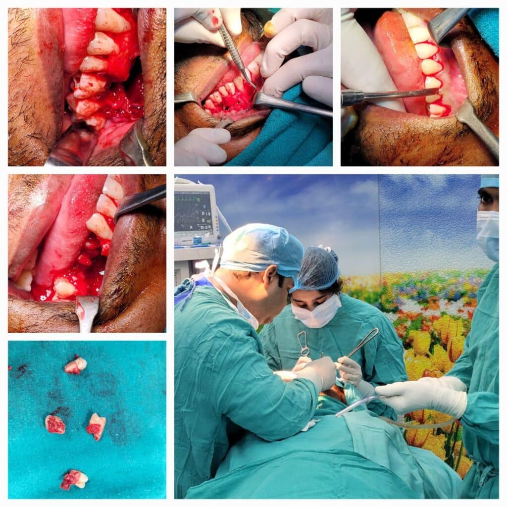 Road accident / Trauma