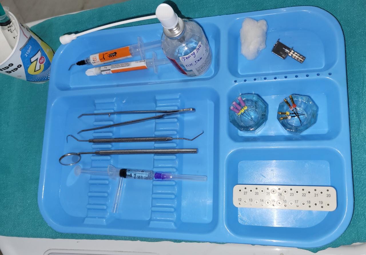 Root Canal Treatment by DR. Aishwarya