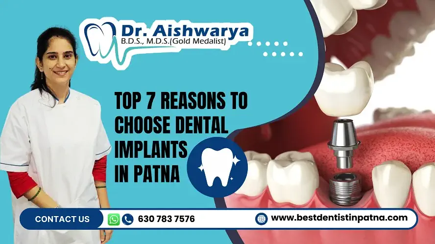 Dental Implant in Patna