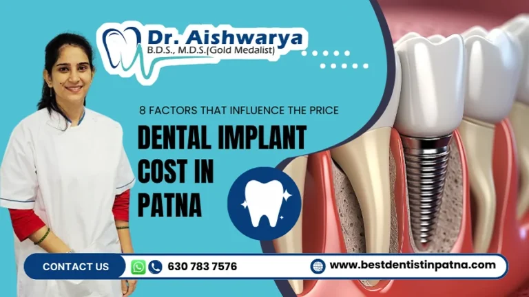 dental implant cost in Patna