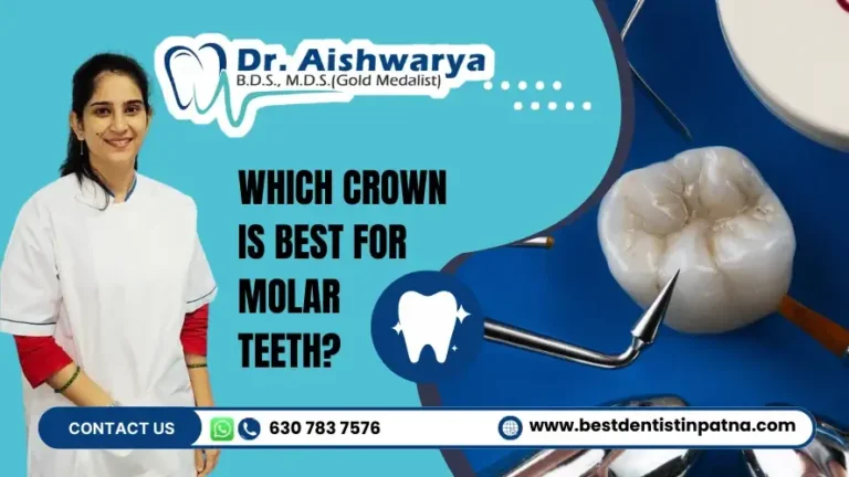 Which Crown is Best For Molar Teeth