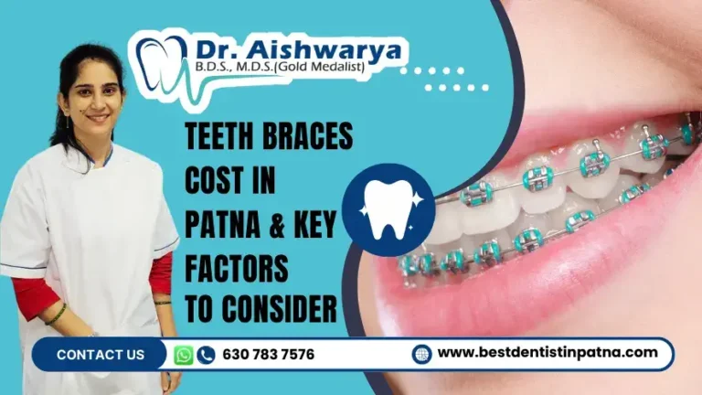 Teeth Braces Cost in Patna