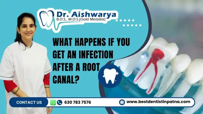 What Happens If You Get an Infection After a Root Canal?