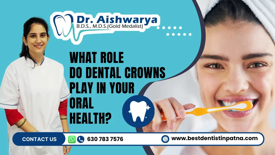Role of Dental Crowns