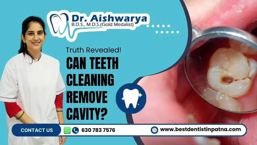 Can teeth cleaning remove cavity?