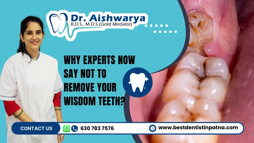 wisdom teeth removal