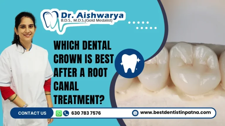 dental crown after rct