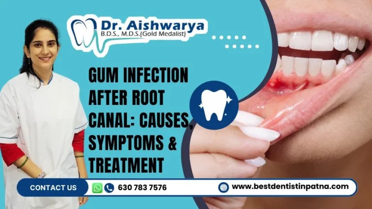Gum swelling after root canal treatment
