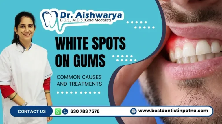 White Spots on Gums