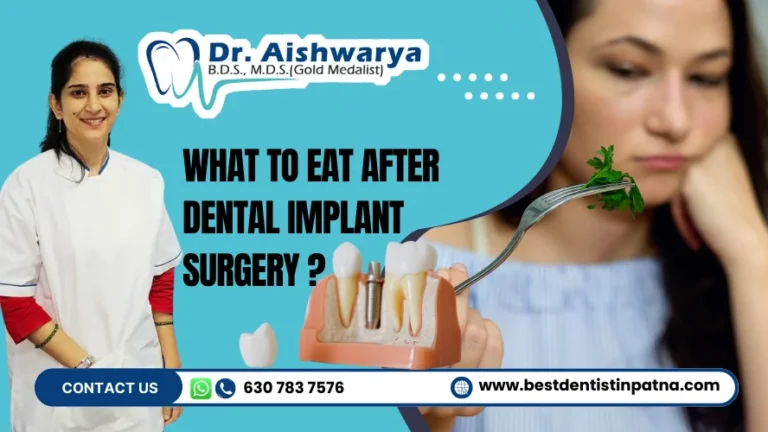 dental implant diet guide