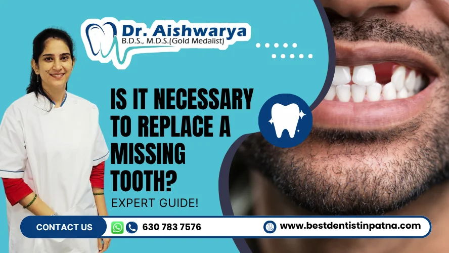 replace missing tooth