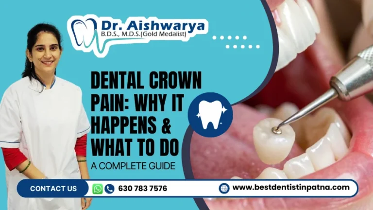 Crown treatment in patna