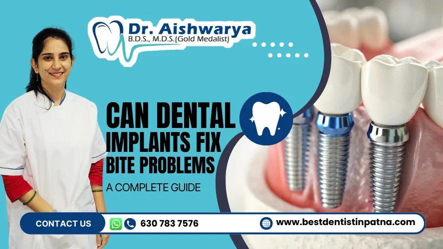 Can Dental Implants Fix Bite Problems
