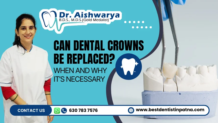 Can Dental Crowns Be Replaced