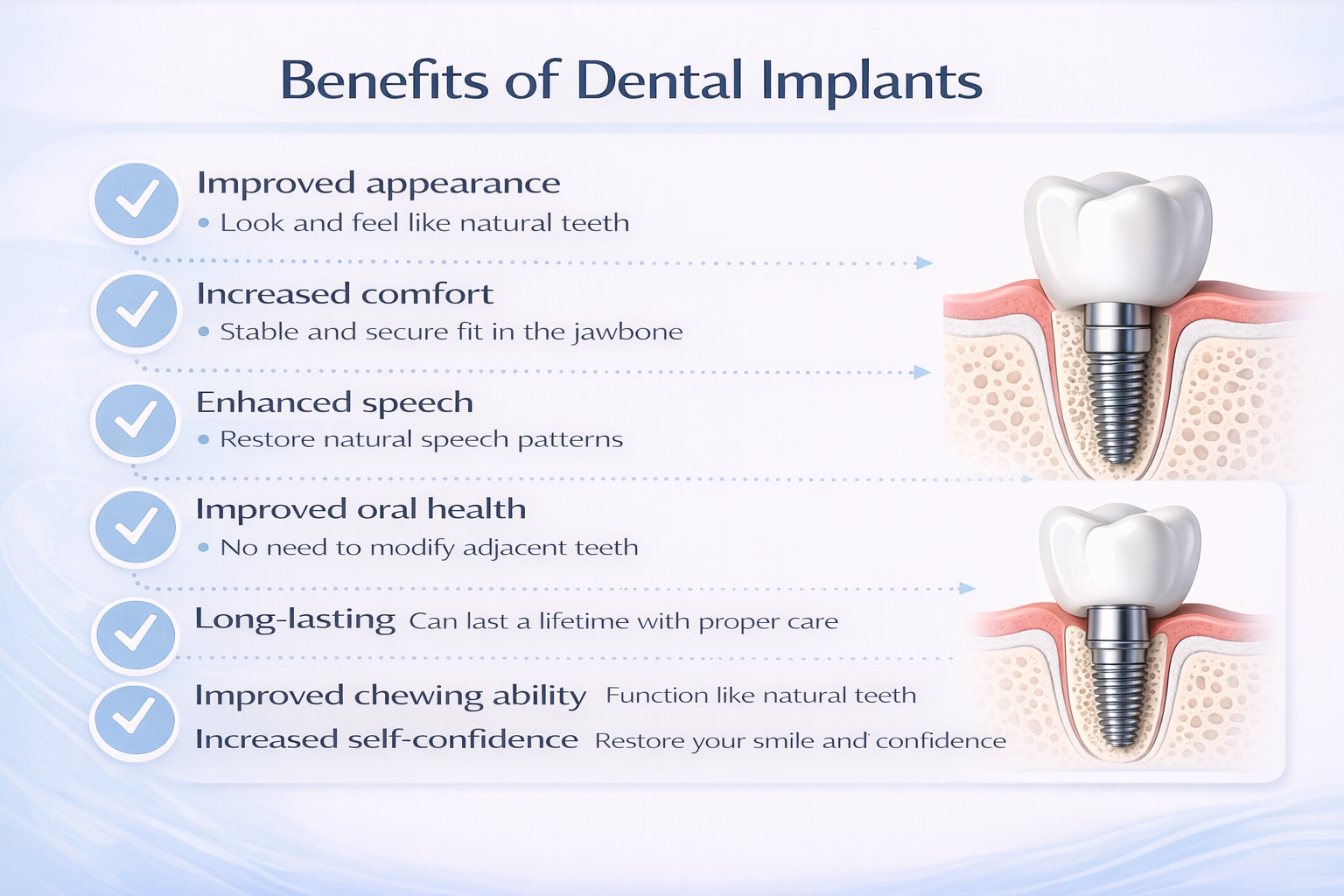 dental implant