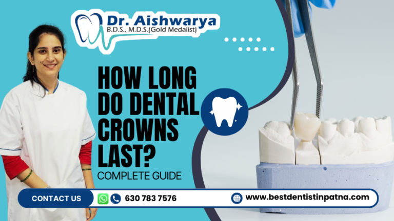How Long Do Dental Crowns Last