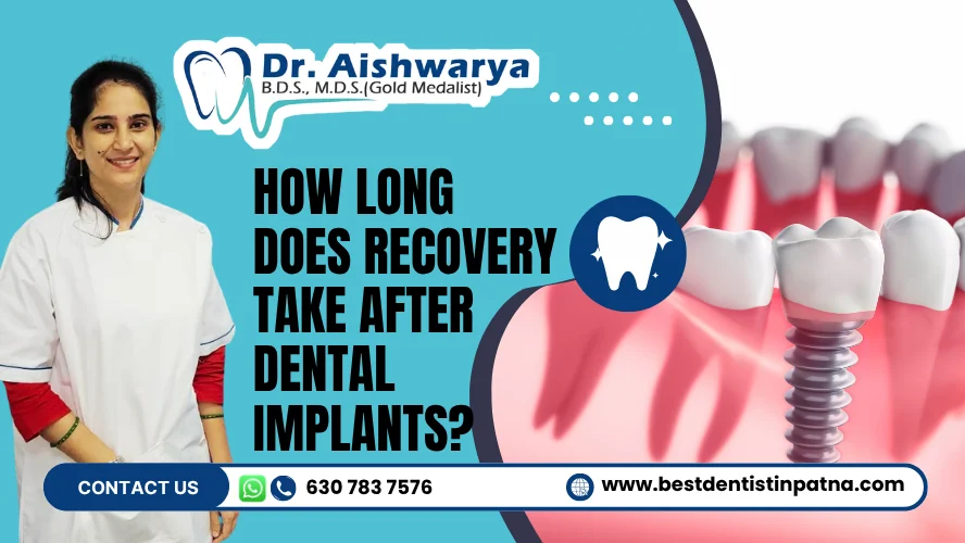 dental implant recovery
