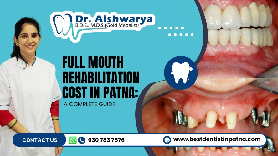 Full Mouth Rehabilitation Cost in Patna