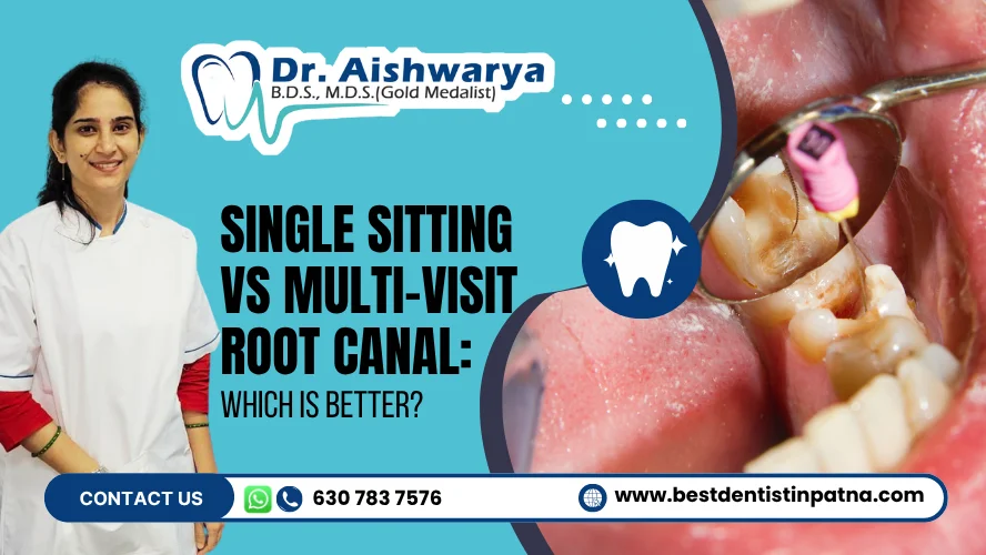 Single Sitting vs Multi-Visit RCT