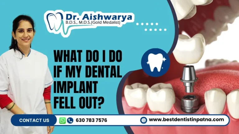 What Do I Do If My Dental Implant Fell Out