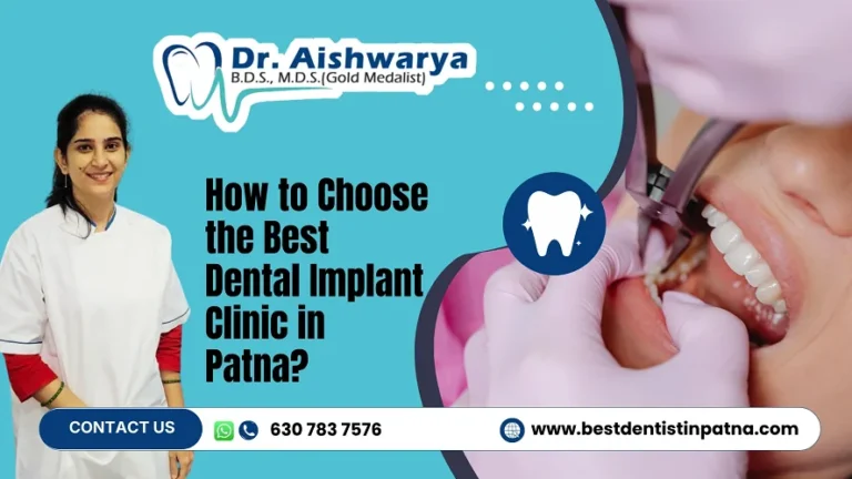 Best Dental Implant Clinic in Patna