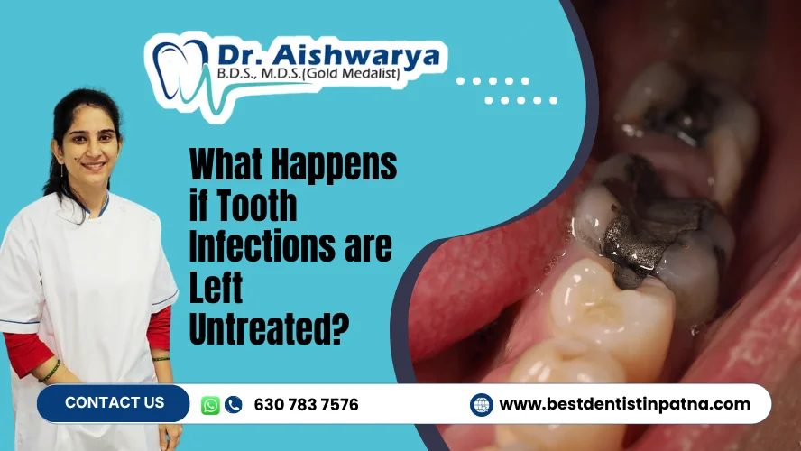 What Happens If Tooth Infections Are Left Untreated