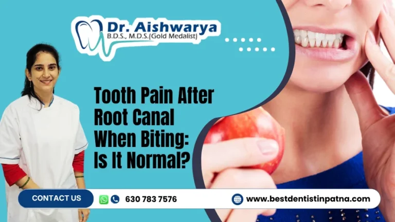 Tooth Pain After Root Canal When Biting