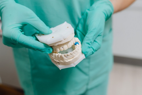 Dental restorations and fillings