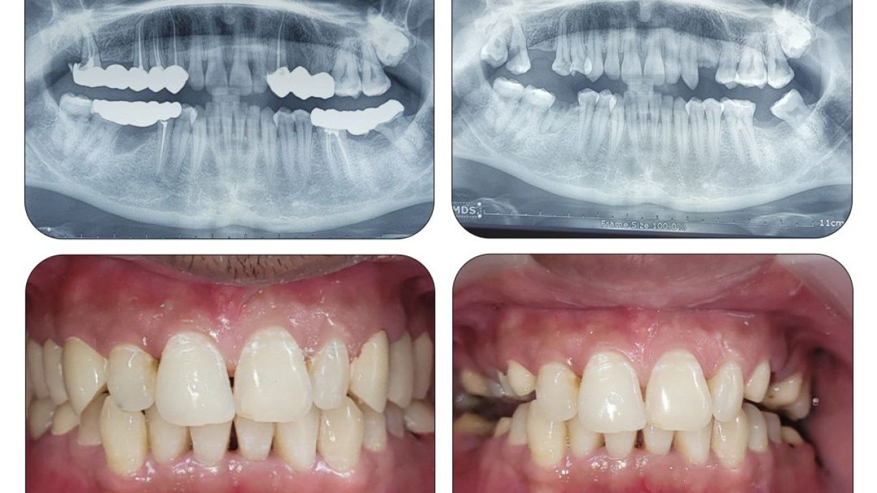Dr.Aishwarya B.D.S, M.D.S, Best dentist in Patna